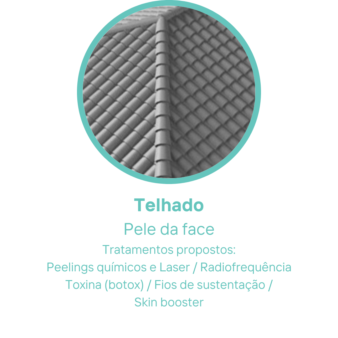 Cópia de Zeca (7).png